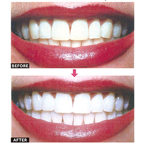 Smile_image01