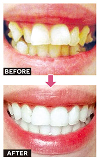 Smile_image02