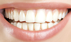 Smile_image01